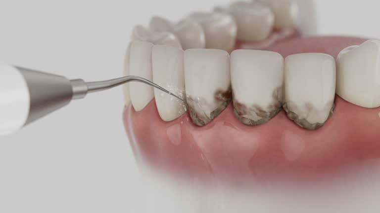 Trusted Dental Crowns And Bridges service in Missoula, MT - Dentist Open Now